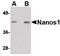 Nanos C2HC-Type Zinc Finger 1 antibody, PA5-20557, Invitrogen Antibodies, Western Blot image 