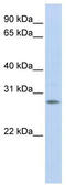 Insulin Like Growth Factor Binding Protein 4 antibody, TA338268, Origene, Western Blot image 