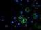 Metabolism Of Cobalamin Associated A antibody, NBP2-03496, Novus Biologicals, Immunofluorescence image 