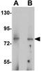 UHRF1 Binding Protein 1 antibody, GTX32029, GeneTex, Western Blot image 