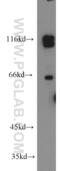 Pre-mRNA-processing factor 40 homolog B antibody, 16929-1-AP, Proteintech Group, Western Blot image 