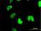 CTNNBL1 antibody, H00056259-M01, Novus Biologicals, Immunofluorescence image 
