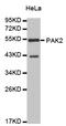 Gamma-PAK antibody, abx126997, Abbexa, Western Blot image 