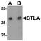 B And T Lymphocyte Associated antibody, TA326653, Origene, Western Blot image 