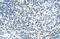 Zinc Finger MYND-Type Containing 11 antibody, 28-167, ProSci, Immunohistochemistry paraffin image 