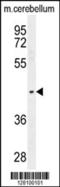 PTOV1 Extended AT-Hook Containing Adaptor Protein antibody, 55-392, ProSci, Western Blot image 