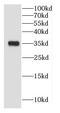 Calponin 1 antibody, FNab01221, FineTest, Western Blot image 