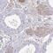 ADAM Metallopeptidase Domain 21 antibody, PA5-63644, Invitrogen Antibodies, Immunohistochemistry frozen image 