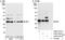 Microtubule Associated Protein RP/EB Family Member 1 antibody, A302-333A, Bethyl Labs, Immunoprecipitation image 