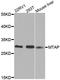 Methylthioadenosine Phosphorylase antibody, MBS2530186, MyBioSource, Western Blot image 
