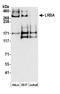 Lipopolysaccharide-responsive and beige-like anchor protein antibody, A304-478A, Bethyl Labs, Western Blot image 