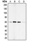 Mothers against decapentaplegic homolog 1 antibody, MBS820523, MyBioSource, Western Blot image 