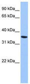 Annexin A8 Like 1 antibody, TA341647, Origene, Western Blot image 
