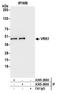 Serine/threonine-protein kinase 51PK antibody, A305-269A, Bethyl Labs, Immunoprecipitation image 