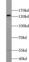Transcriptional Repressor GATA Binding 1 antibody, FNab09025, FineTest, Western Blot image 