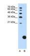 Ribosomal Protein S29 antibody, orb324848, Biorbyt, Western Blot image 