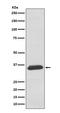 Sarcoglycan Delta antibody, M05297, Boster Biological Technology, Western Blot image 