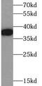 Potassium Voltage-Gated Channel Subfamily A Regulatory Beta Subunit 2 antibody, FNab04479, FineTest, Western Blot image 