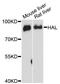 Histidase antibody, A13021, ABclonal Technology, Western Blot image 