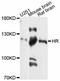 Protein hairless antibody, abx125963, Abbexa, Western Blot image 