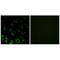 Ribosomal Protein S4 X-Linked antibody, A09096, Boster Biological Technology, Immunohistochemistry paraffin image 