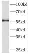 Pyruvate Kinase M1/2 antibody, FNab06493, FineTest, Western Blot image 
