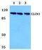 Chloride Voltage-Gated Channel 1 antibody, PA5-37147, Invitrogen Antibodies, Western Blot image 