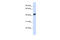 Zinc Finger RANBP2-Type Containing 2 antibody, 25-384, ProSci, Western Blot image 