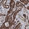 Coiled-Coil Domain Containing 82 antibody, HPA038704, Atlas Antibodies, Immunohistochemistry paraffin image 