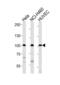 EPH Receptor A4 antibody, GTX25396, GeneTex, Western Blot image 