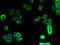 Progestin And AdipoQ Receptor Family Member 5 antibody, A67994-100, Epigentek, Immunofluorescence image 