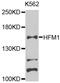 Helicase For Meiosis 1 antibody, A8600, ABclonal Technology, Western Blot image 
