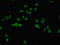 Jumonji And AT-Rich Interaction Domain Containing 2 antibody, LS-C678391, Lifespan Biosciences, Immunofluorescence image 