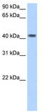 Pregnancy Specific Beta-1-Glycoprotein 5 antibody, TA346330, Origene, Western Blot image 