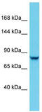 DENN Domain Containing 4C antibody, TA331875, Origene, Western Blot image 