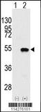 SET And MYND Domain Containing 2 antibody, TA302185, Origene, Western Blot image 