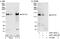 Centrosomal protein CP110 antibody, A301-344A, Bethyl Labs, Immunoprecipitation image 