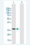 N(2),N(2)-dimethylguanosine tRNA methyltransferase antibody, H00055687-B01P-50ug, Novus Biologicals, Western Blot image 