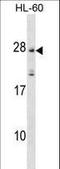 Membrane Spanning 4-Domains A5 antibody, LS-C158315, Lifespan Biosciences, Western Blot image 