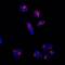 Lysosomal Associated Membrane Protein 2 antibody, NBP2-22217, Novus Biologicals, Immunofluorescence image 