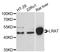 Lecithin retinol acyltransferase antibody, A13175, ABclonal Technology, Western Blot image 
