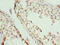 Eukaryotic Translation Initiation Factor 5A2 antibody, A67474-100, Epigentek, Immunohistochemistry paraffin image 