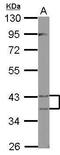 Enoyl-CoA Delta Isomerase 2 antibody, PA5-32008, Invitrogen Antibodies, Western Blot image 