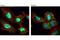 TIA1 Cytotoxic Granule Associated RNA Binding Protein Like 1 antibody, 8509P, Cell Signaling Technology, Immunofluorescence image 