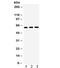 Hnf-1b antibody, R32080, NSJ Bioreagents, Western Blot image 