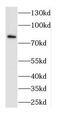 Src substrate cortactin antibody, FNab01886, FineTest, Western Blot image 