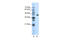 Zinc finger protein 36, C3H1 type-like 2 antibody, 28-959, ProSci, Western Blot image 
