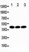 TATA-Box Binding Protein antibody, LS-C312691, Lifespan Biosciences, Western Blot image 
