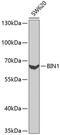 Bridging Integrator 1 antibody, 18-160, ProSci, Western Blot image 