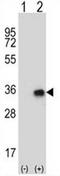CCR4-NOT transcription complex subunit 8 antibody, AP50989PU-N, Origene, Western Blot image 